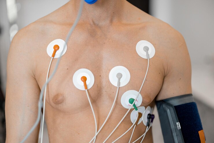 4 dicas para posicionar eletrodos ecg