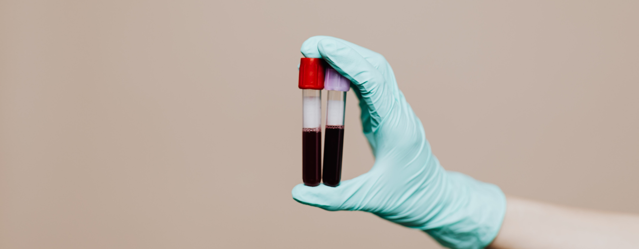 enfermeiro médico segurando tubo de ensaio com tampa vermelha com amostra de sangue utilizando uma luva azul de procedimento